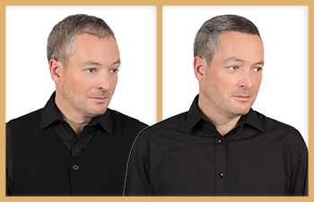 Antes y Después de usar Kapilab Paul